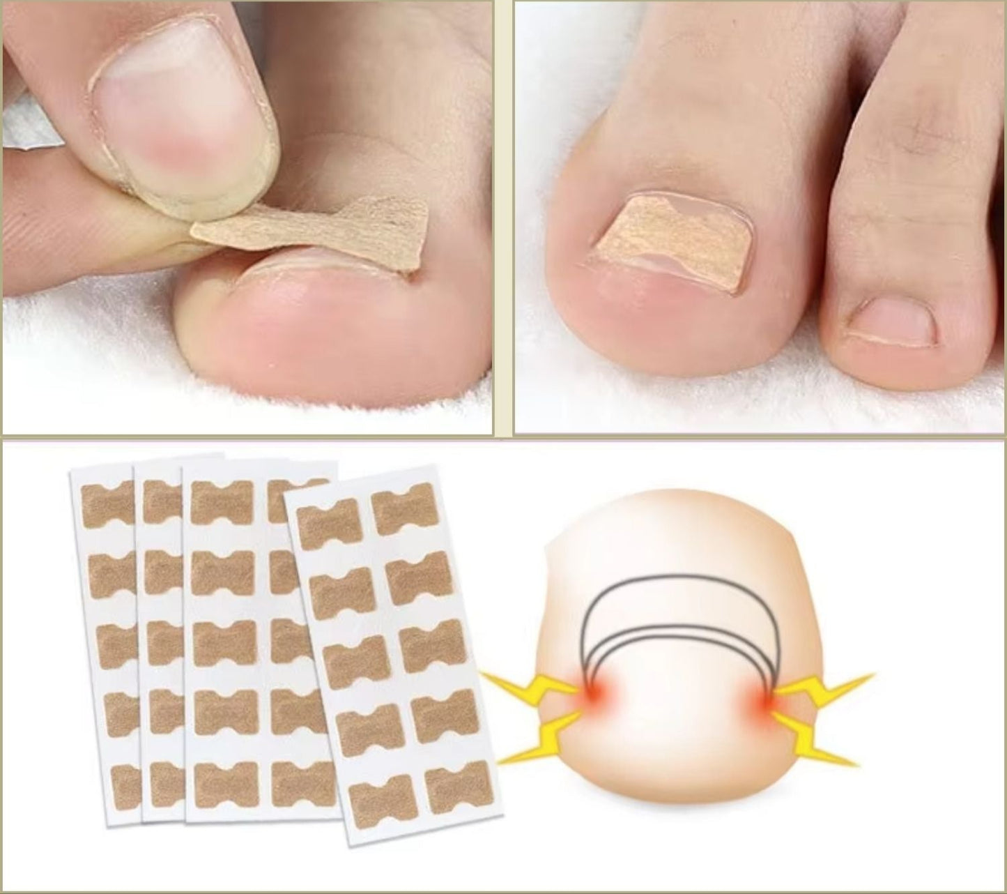 FixaNail™ | Herstel en versterk je nagels – zonder salonbezoek!