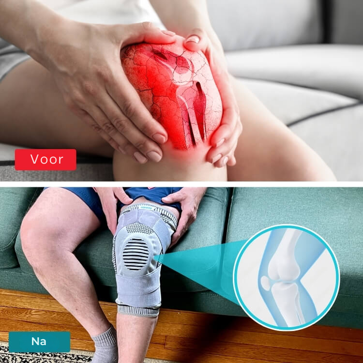 SteunKracht Pro – Kniebrace voor dagelijkse comfort