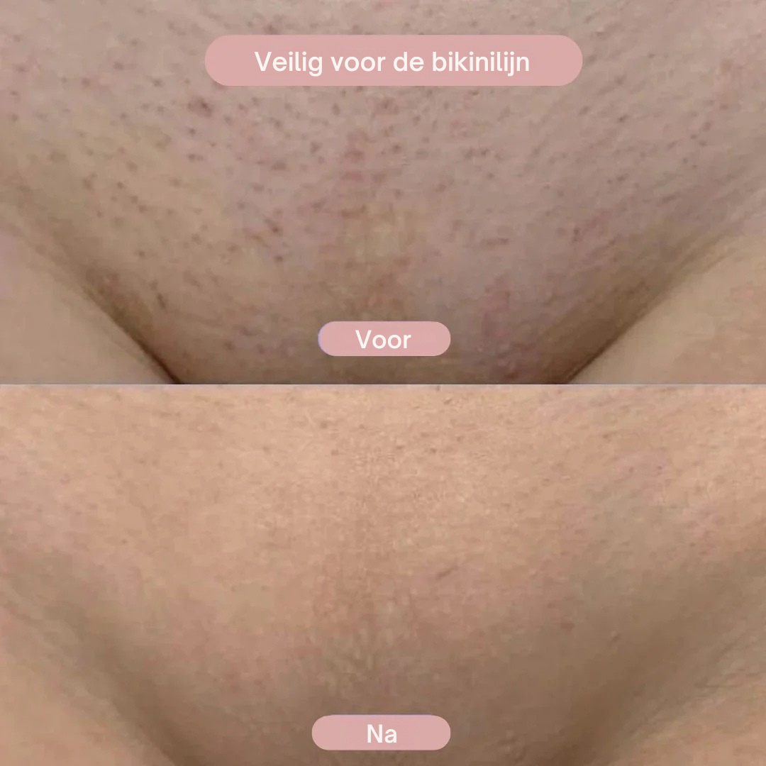 SilkPure™ - 2-in-1 Scheerapparaat voor Vrouwen