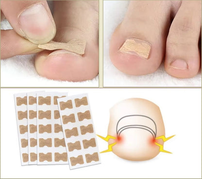FixaNail™ | Herstel en versterk je nagels – zonder salonbezoek!