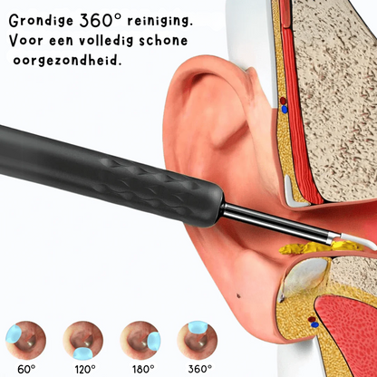 VisioEar: De high-tech oplossing voor veilige oorreiniging