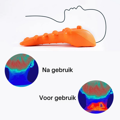 TheraPoint™ |  Triggerpoint-massageapparaat