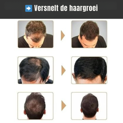 Lunoon- Wortelactiverende Shampoo tegen haaruitval